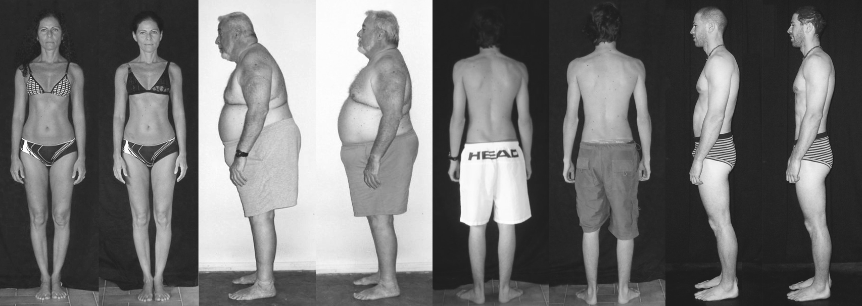 Results before & after 10 Rolfing® sessions.